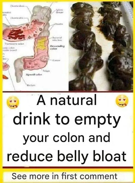 Natural Colon Cleanse Drink to Reduce Belly Bloat and Support Digestion