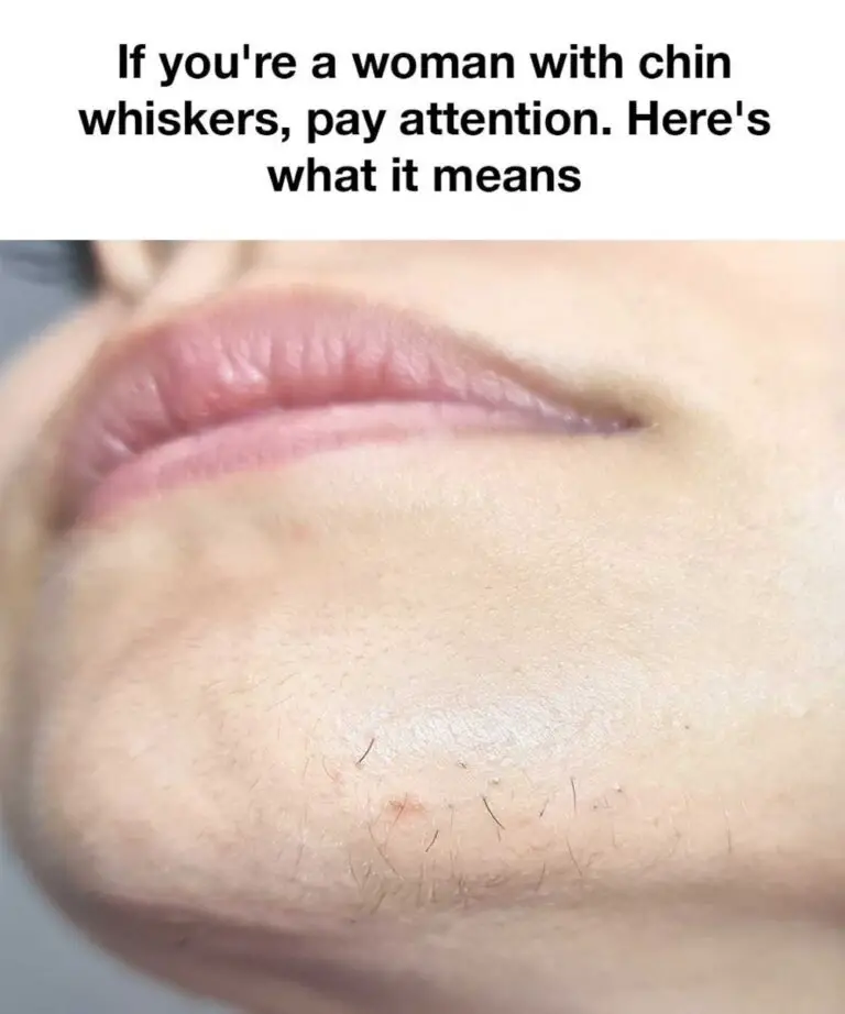 Surprised by Chin Whiskers? You’re Not Alone