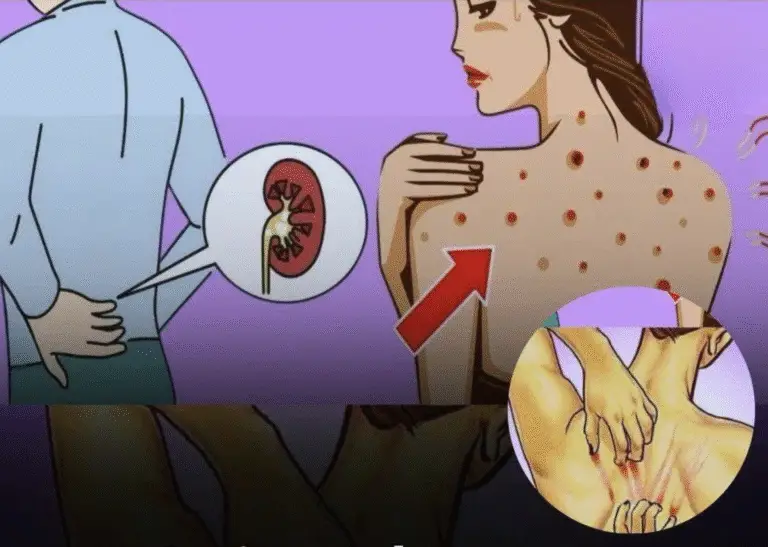 10 Warning Signs Your Kidneys May Be in Danger — And What to Do About It