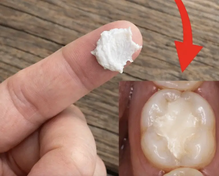 5 Simple Natural Home Remedies to Help Prevent Cavities and Support Healthy Teeth