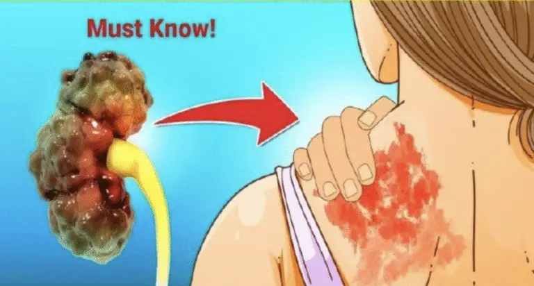 9 Warning Signs Your Kidneys Are Failing | Tests to Avoid Dialysis