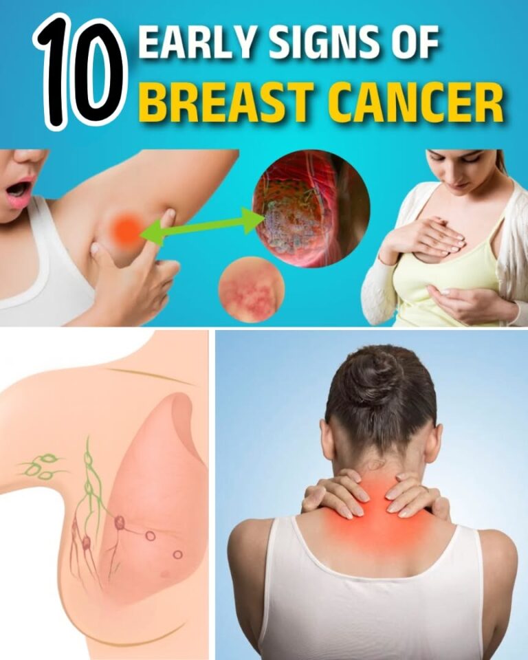 10 Warning Signs of Breast Cancer You Should Never Ignore