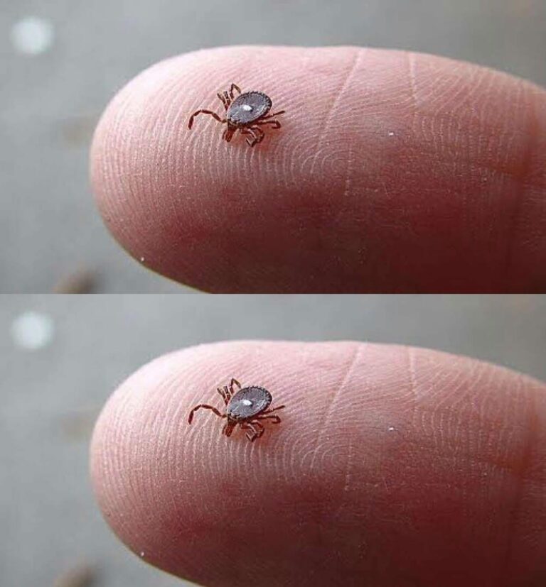 Don’t Panic-Here’s What to Do If You Find a Lone Star Tick