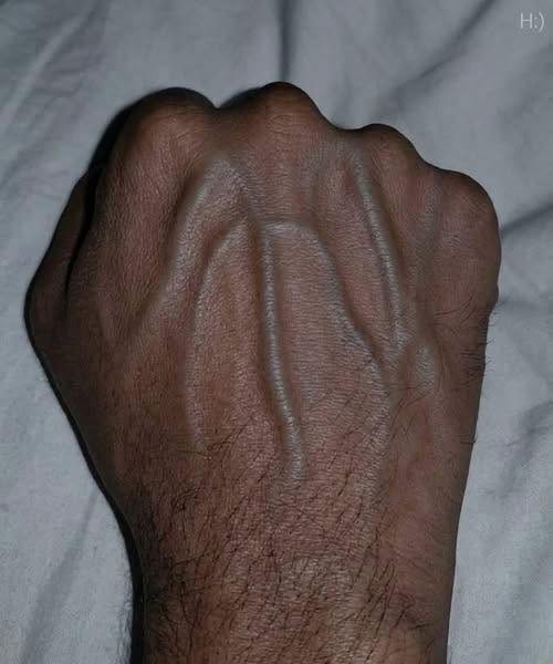 If You Have Visible Veins, Here’s What They May Actually Mean