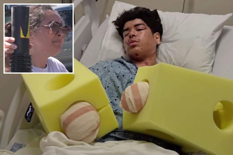 California Mom Issues Urgent Fireworks Warning After Teen Suffers Devastating Hand Injuries